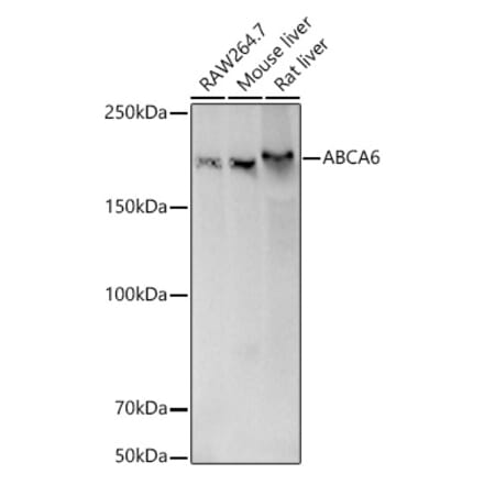 Western Blot - Anti-ABCA6 Antibody (A308785) - Antibodies.com