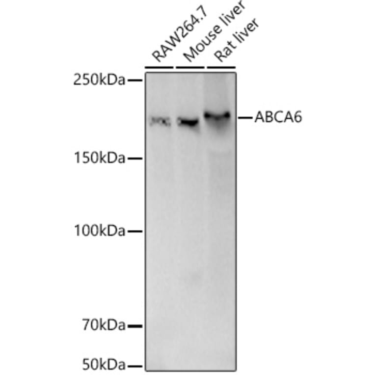 Western Blot - Anti-ABCA6 Antibody (A308785) - Antibodies.com