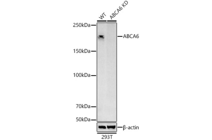 Western Blot - Anti-ABCA6 Antibody (A308785) - Antibodies.com