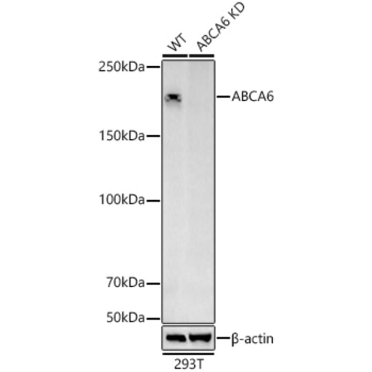 Western Blot - Anti-ABCA6 Antibody (A308785) - Antibodies.com
