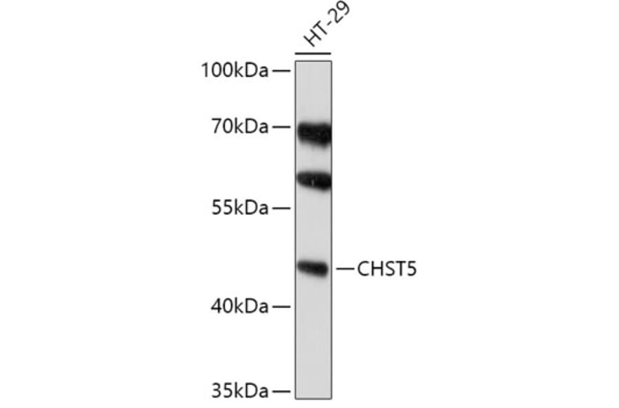 Western Blot - Anti-CHST5 Antibody (A308787) - Antibodies.com