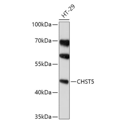 Western Blot - Anti-CHST5 Antibody (A308787) - Antibodies.com