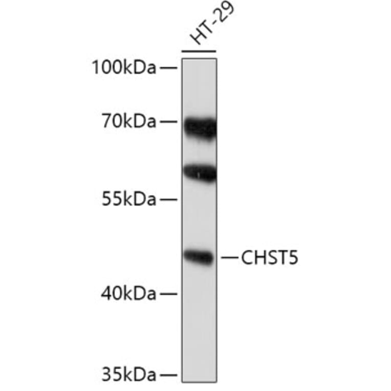 Western Blot - Anti-CHST5 Antibody (A308787) - Antibodies.com