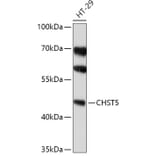 Western Blot - Anti-CHST5 Antibody (A308787) - Antibodies.com