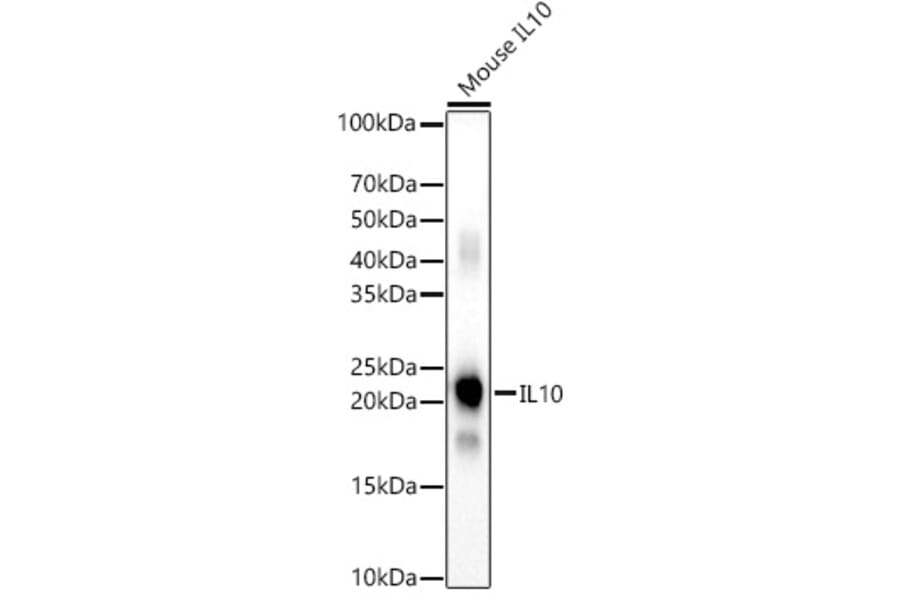 Western Blot - Anti-IL-10 Antibody (A308789) - Antibodies.com
