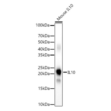 Western Blot - Anti-IL-10 Antibody (A308789) - Antibodies.com