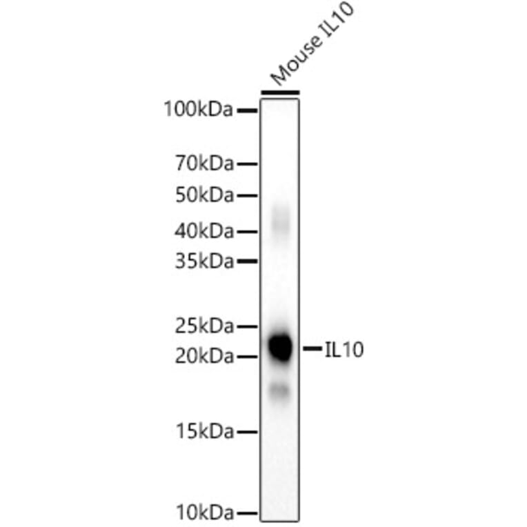 Western Blot - Anti-IL-10 Antibody (A308789) - Antibodies.com