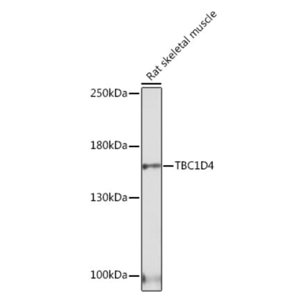 Western Blot - Anti-AS160 Antibody (A308790) - Antibodies.com