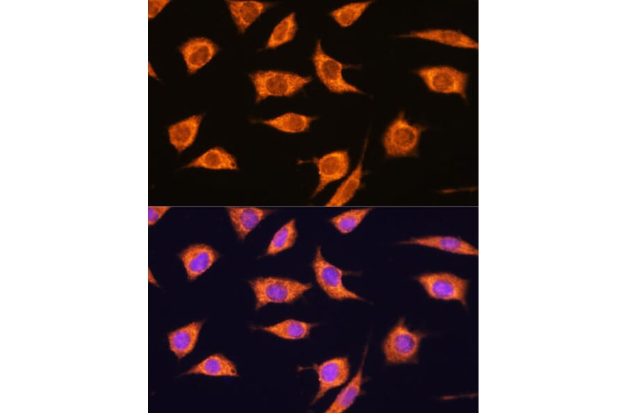 Immunofluorescence - Anti-AS160 Antibody (A308790) - Antibodies.com