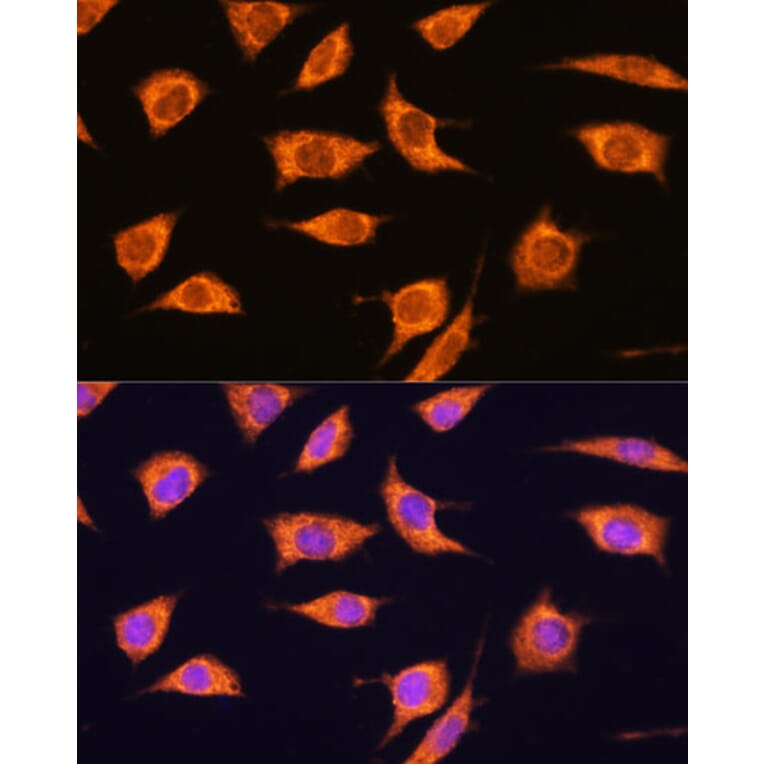 Immunofluorescence - Anti-AS160 Antibody (A308790) - Antibodies.com