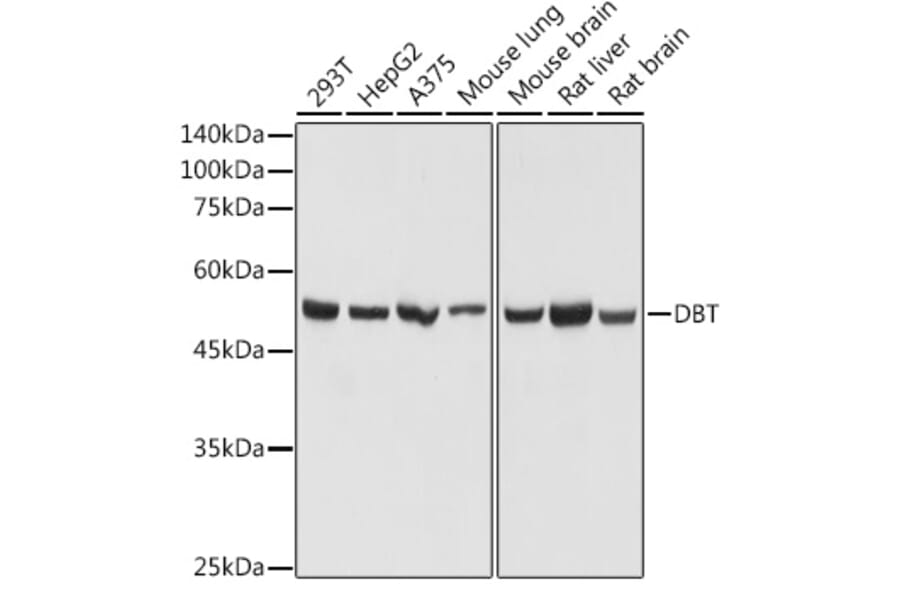 Western Blot - Anti-DBT Antibody (A308791) - Antibodies.com