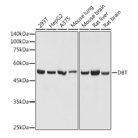 Western Blot - Anti-DBT Antibody (A308791) - Antibodies.com