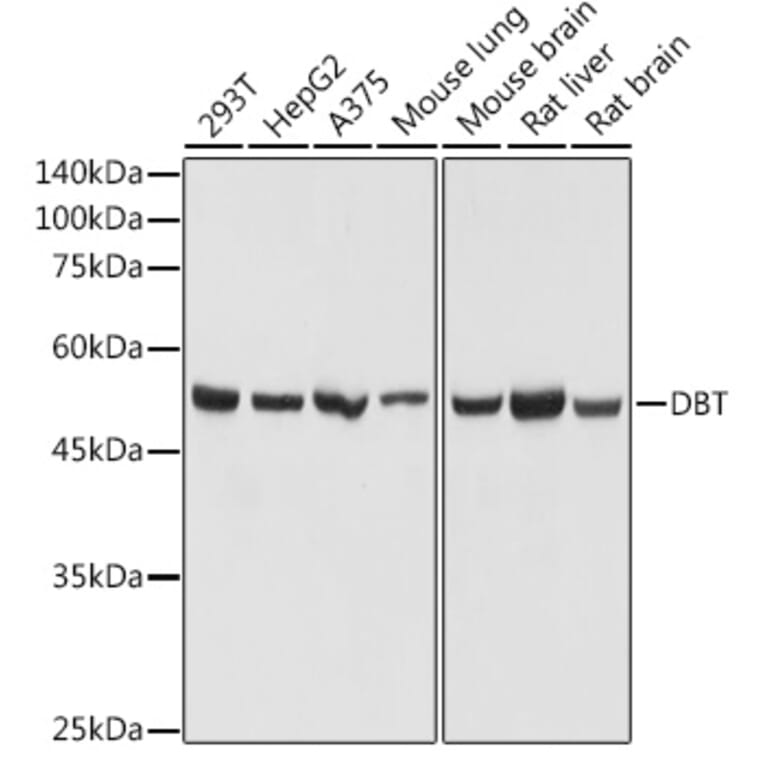 Western Blot - Anti-DBT Antibody (A308791) - Antibodies.com
