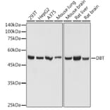 Western Blot - Anti-DBT Antibody (A308791) - Antibodies.com