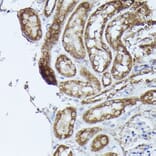 Immunohistochemistry - Anti-DBT Antibody (A308791) - Antibodies.com