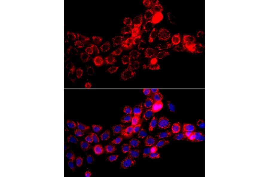Immunofluorescence - Anti-DBT Antibody (A308791) - Antibodies.com