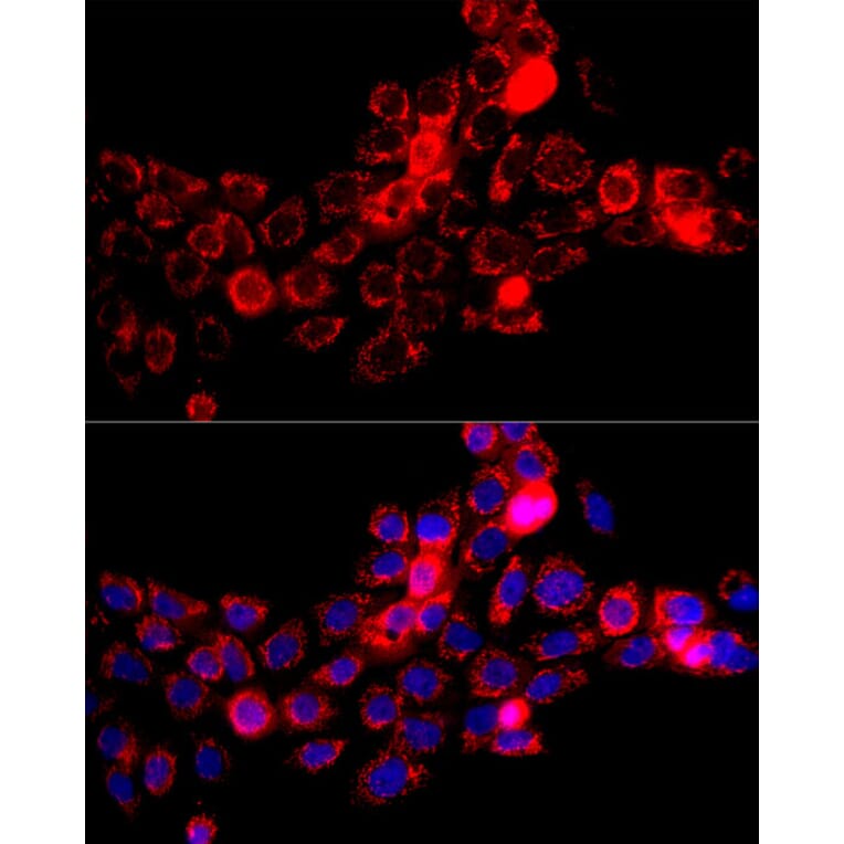 Immunofluorescence - Anti-DBT Antibody (A308791) - Antibodies.com