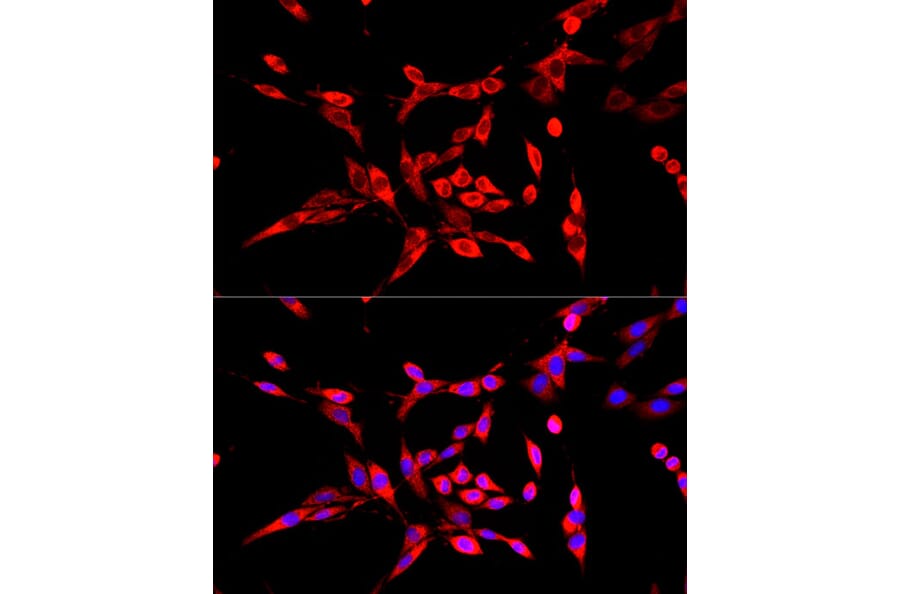 Immunofluorescence - Anti-DBT Antibody (A308791) - Antibodies.com