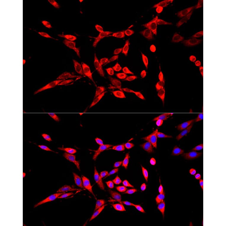 Immunofluorescence - Anti-DBT Antibody (A308791) - Antibodies.com