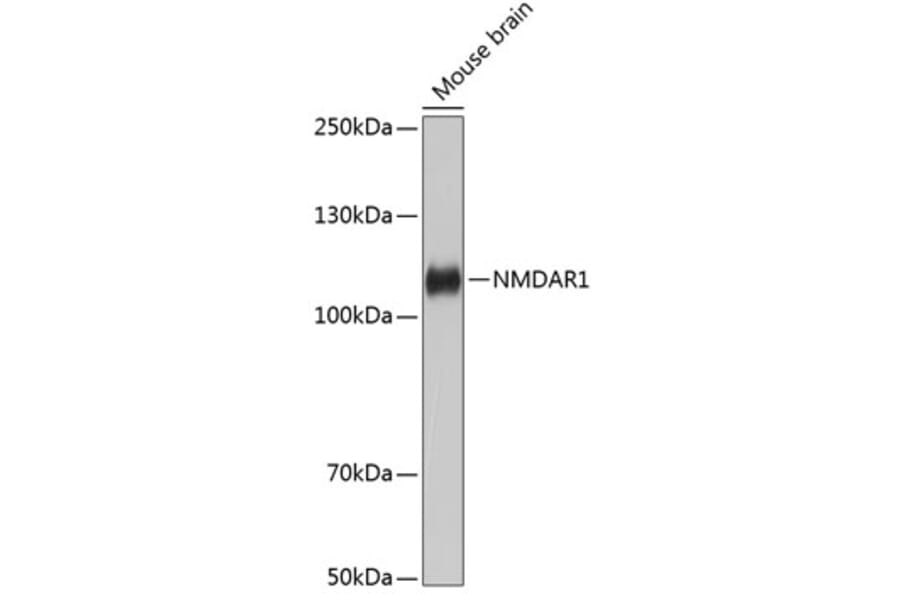 Western Blot - Anti-NMDAR1 Antibody [ARC0684] (A308794) - Antibodies.com