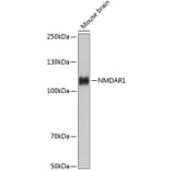 Western Blot - Anti-NMDAR1 Antibody [ARC0684] (A308794) - Antibodies.com