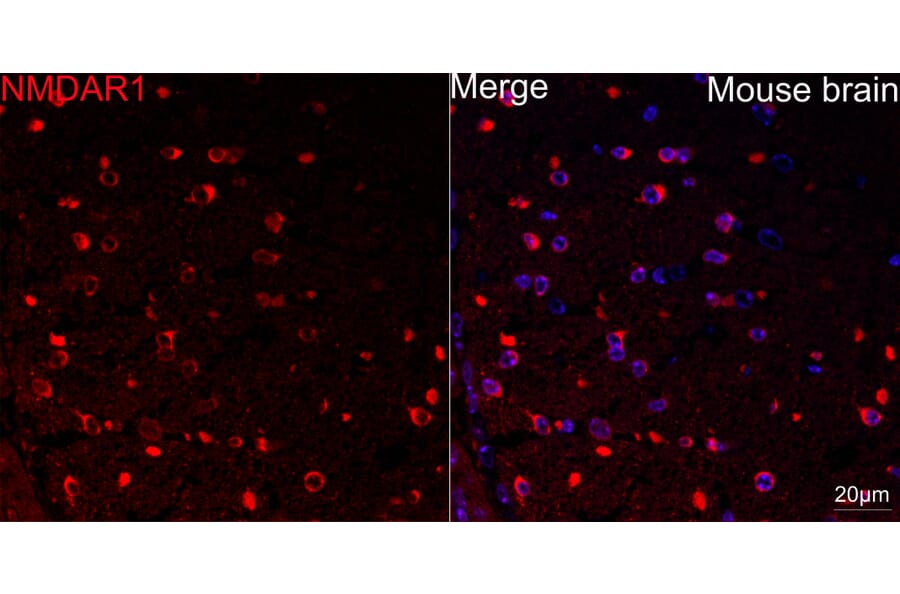 Immunofluorescence - Anti-NMDAR1 Antibody [ARC0684] (A308794) - Antibodies.com