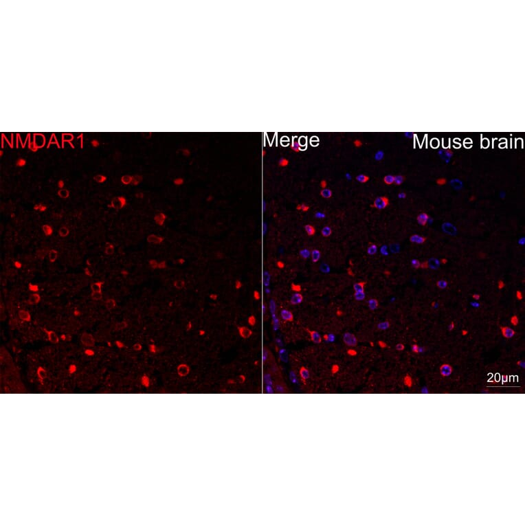 Immunofluorescence - Anti-NMDAR1 Antibody [ARC0684] (A308794) - Antibodies.com