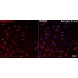 Immunofluorescence - Anti-NMDAR1 Antibody [ARC0684] (A308794) - Antibodies.com