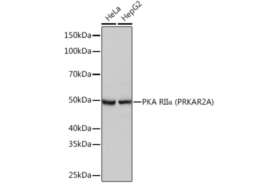 Western Blot - Anti-PKA R2/PKR2 Antibody [ARC0860] (A308795) - Antibodies.com