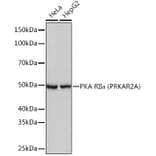 Western Blot - Anti-PKA R2/PKR2 Antibody [ARC0860] (A308795) - Antibodies.com