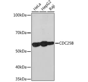 Western Blot - Anti-Cdc25B Antibody [ARC1736] (A308797) - Antibodies.com