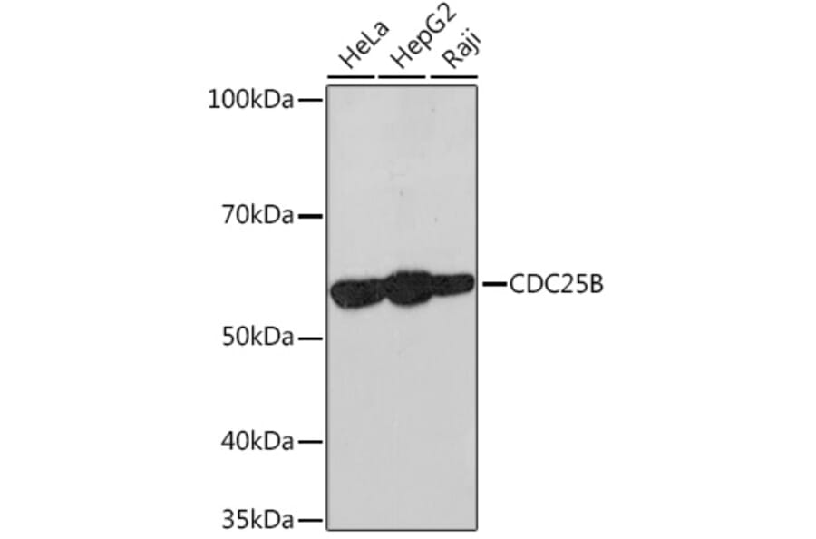 Western Blot - Anti-Cdc25B Antibody [ARC1736] (A308797) - Antibodies.com