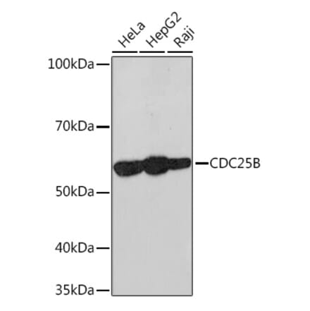 Western Blot - Anti-Cdc25B Antibody [ARC1736] (A308797) - Antibodies.com