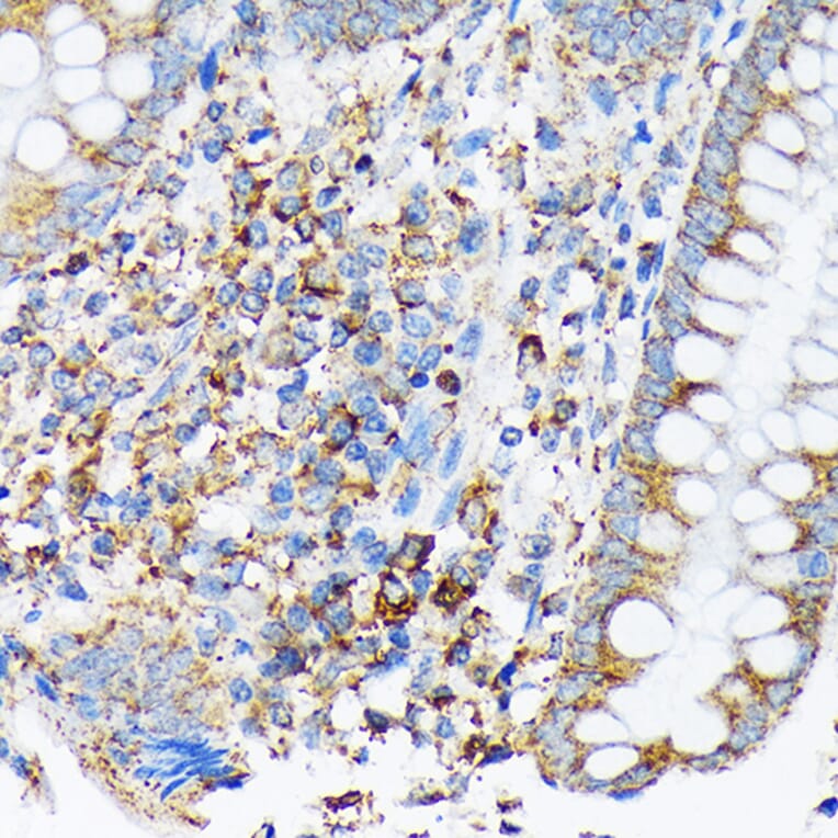 Immunohistochemistry - Anti-Cdc25B Antibody [ARC1736] (A308797) - Antibodies.com