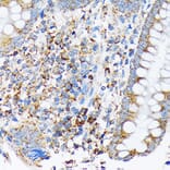 Immunohistochemistry - Anti-Cdc25B Antibody [ARC1736] (A308797) - Antibodies.com