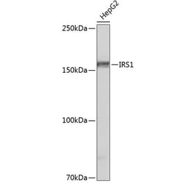 Western Blot - Anti-IRS1 Antibody (A308798) - Antibodies.com
