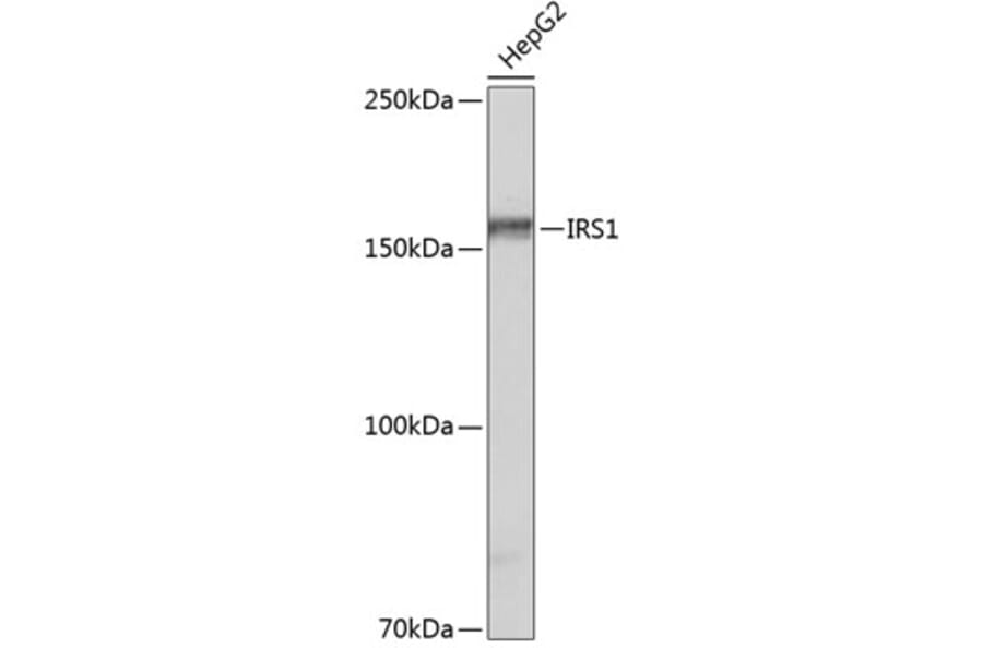 Western Blot - Anti-IRS1 Antibody [ARC0486] (A308798) - Antibodies.com