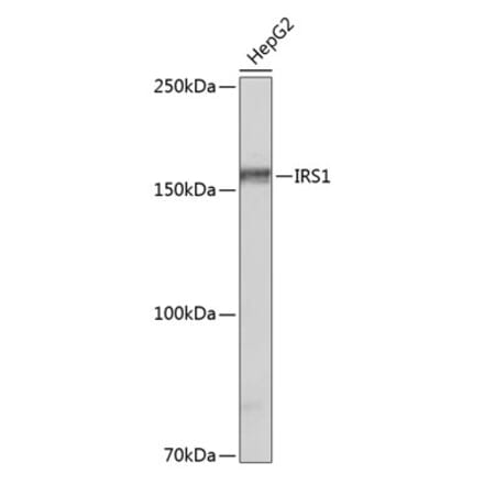 Western Blot - Anti-IRS1 Antibody [ARC0486] (A308798) - Antibodies.com