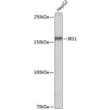 Western Blot - Anti-IRS1 Antibody [ARC0486] (A308798) - Antibodies.com