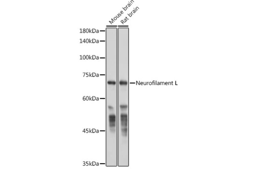 Western Blot - Anti-68kDa Neurofilament/NF-L Antibody [ARC50056] (A308799) - Antibodies.com