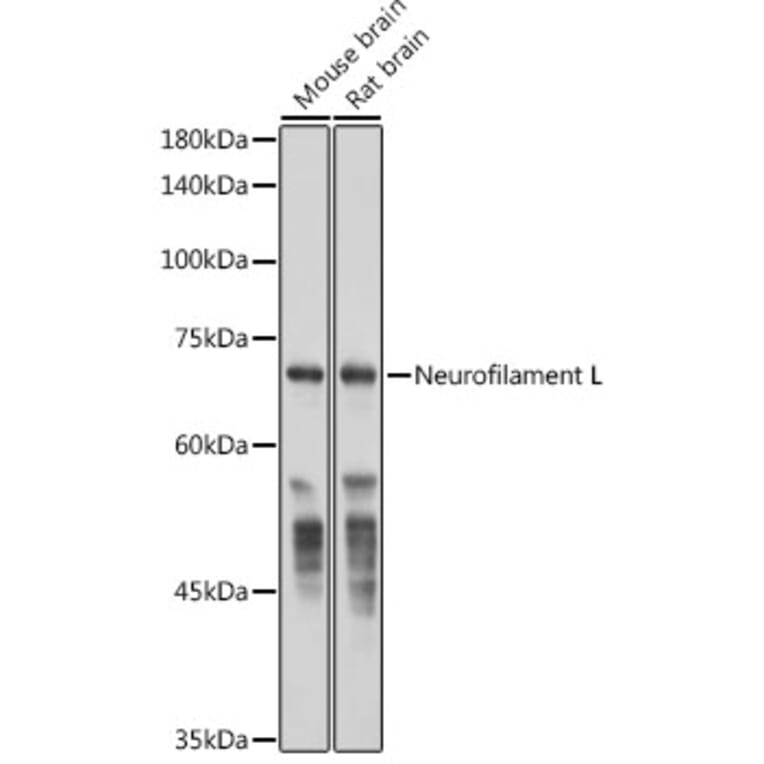 Western Blot - Anti-68kDa Neurofilament/NF-L Antibody [ARC50056] (A308799) - Antibodies.com
