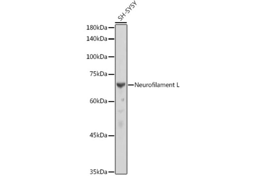 Western Blot - Anti-68kDa Neurofilament/NF-L Antibody [ARC50056] (A308799) - Antibodies.com