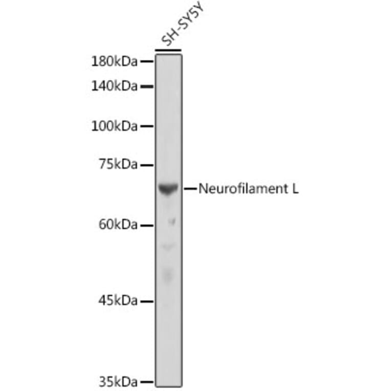 Western Blot - Anti-68kDa Neurofilament/NF-L Antibody [ARC50056] (A308799) - Antibodies.com