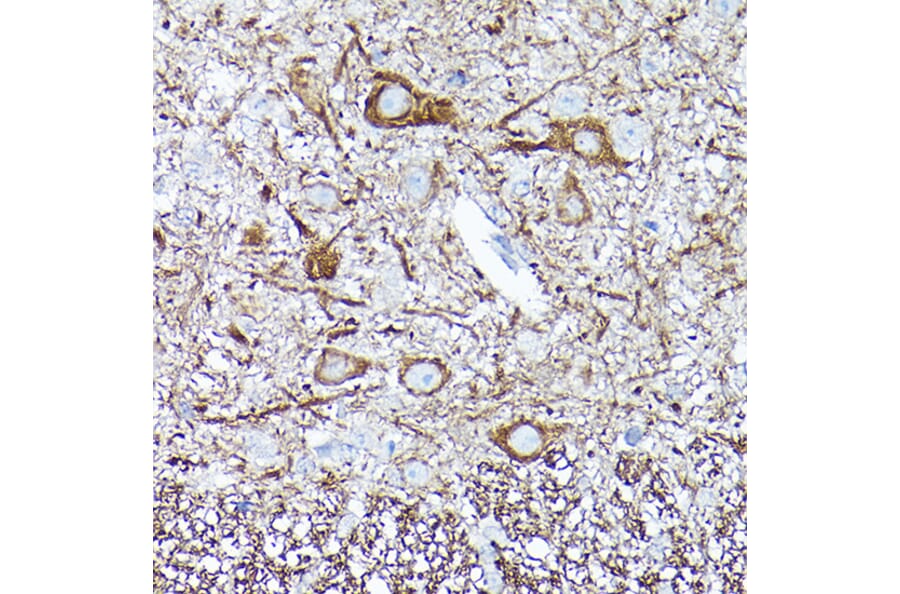 Immunohistochemistry - Anti-68kDa Neurofilament/NF-L Antibody [ARC50056] (A308799) - Antibodies.com
