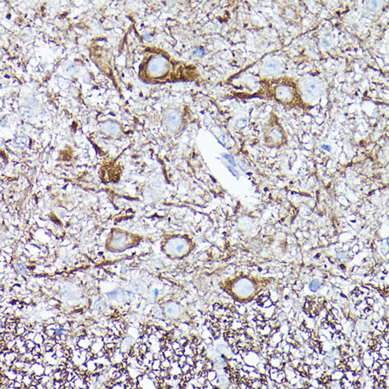 Immunohistochemistry - Anti-68kDa Neurofilament/NF-L Antibody [ARC50056] (A308799) - Antibodies.com