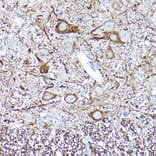 Immunohistochemistry - Anti-68kDa Neurofilament/NF-L Antibody [ARC50056] (A308799) - Antibodies.com