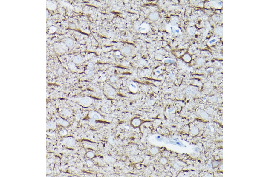 Immunohistochemistry - Anti-68kDa Neurofilament/NF-L Antibody [ARC50056] (A308799) - Antibodies.com