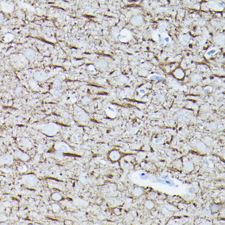 Immunohistochemistry - Anti-68kDa Neurofilament/NF-L Antibody [ARC50056] (A308799) - Antibodies.com