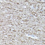 Immunohistochemistry - Anti-68kDa Neurofilament/NF-L Antibody [ARC50056] (A308799) - Antibodies.com