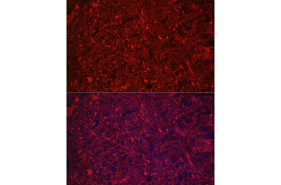 Immunofluorescence - Anti-68kDa Neurofilament/NF-L Antibody [ARC50056] (A308799) - Antibodies.com